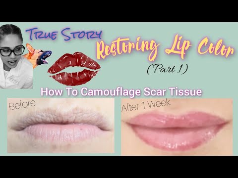 Lip Color Restore (Part 1) - Trauma Victim