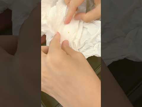 Extracting Hidden Gold Wrapped in Tissue 🎉 #Gold recovery #jewelry  #Hidden gold