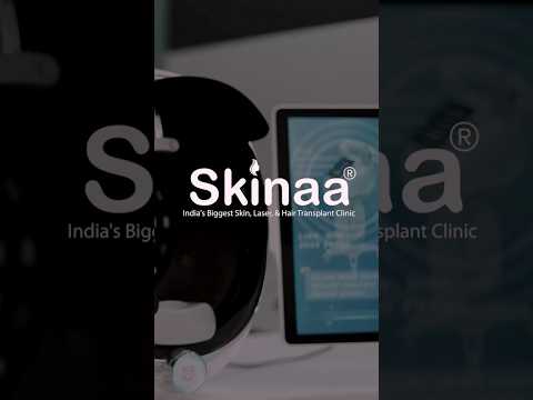 Get Your Skin Analyzed with Skinaa’s Advanced Skin Machine! #viral