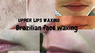upper lips waxing 😱/how to do brazilian face waxing. facial Hair remove waxing😯/#facewaxing #waxing