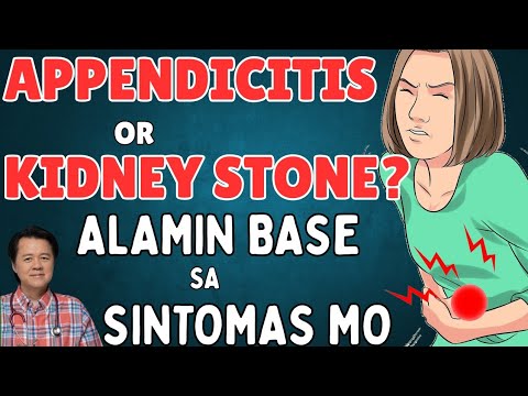 Appendicitis or Kidney Stone? - By Doc Willie Ong (Internist and Cardiologist)