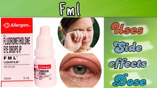 fml eye drops | fml eye drops in hindi | fml eye drops uses | fluorometholone eye drops